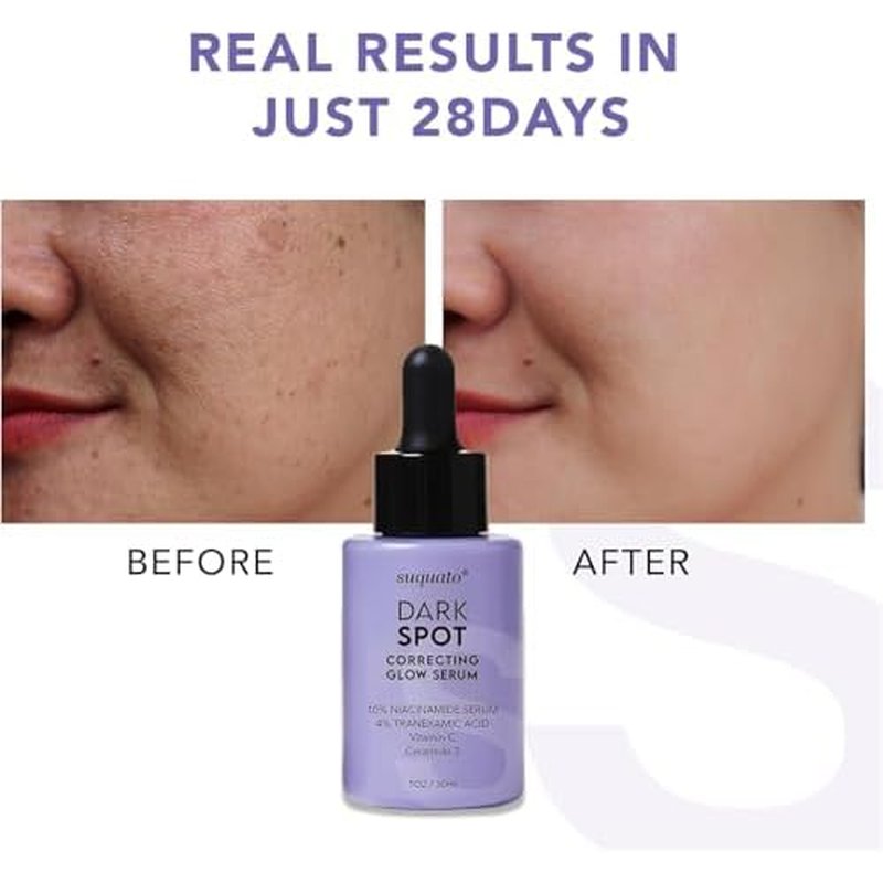 Dark Spot Remover Serum ? For Face Hyperpigmentation & Melasma Care ? Brightening & Dark Spot Correcting Glow with Tranexamic Acid + Niacinamide + Vitamin C (30ml)