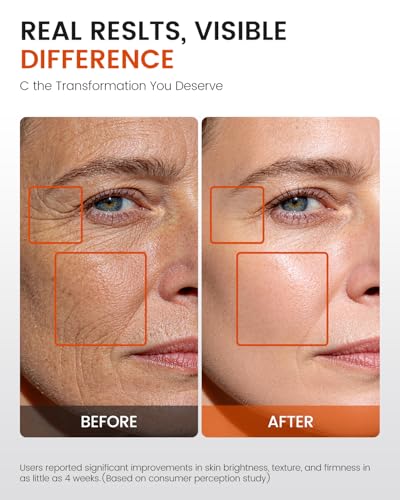 Fioraen Super C Serum for Mature Skin 2 Fl Oz All-in-One Vitamin C with Retinol & Hyaluronic Acid