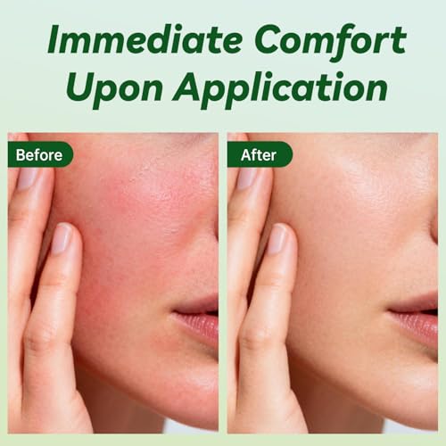 Triamicinolona Cream 2 Pack, 0.1%, Non-Irritating Cream, For All Skin Types, 30g
