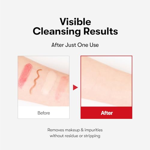 Azelaic Acid Cleansing Oil for Acne & Sensitive Skin - 200ml