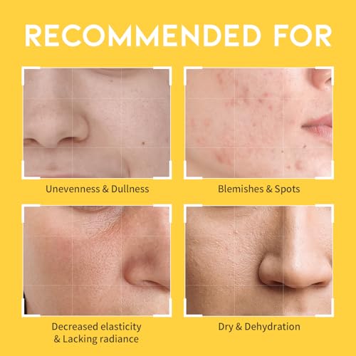 Vitamin C Niacinamide Toner for Face - Hydrating Korean Skincare, 8.45 fl oz