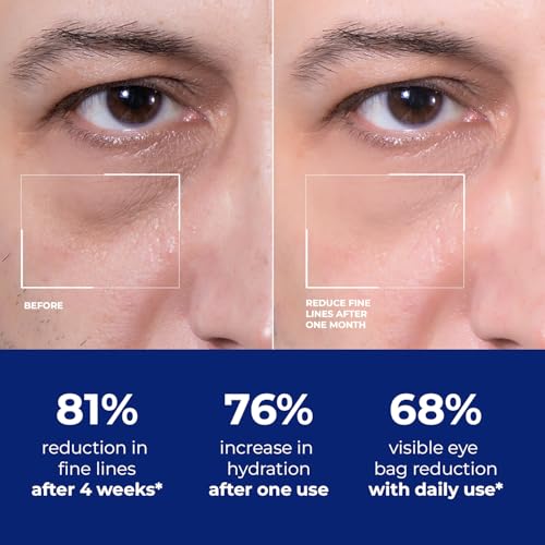 Mens Eye-Bags Treatment Cream: Under Eye Repair for wrinkles Baggy Puffiness and Dark Circles - Anti-aging Hydrating with Peptides + Hyaluronic Acid + Niacinamide + Botanical complex+VC
