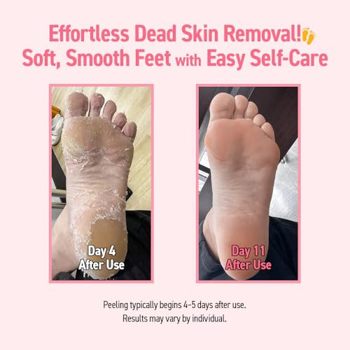 VOESH Peeling Socks Duo, Foot Peeling Mask, Intensive Foot Peel, Callus Remover, Exfoliating Foot Mask, Foot Peel for Dry Feet, Vegan K-Beauty Korean Skincare