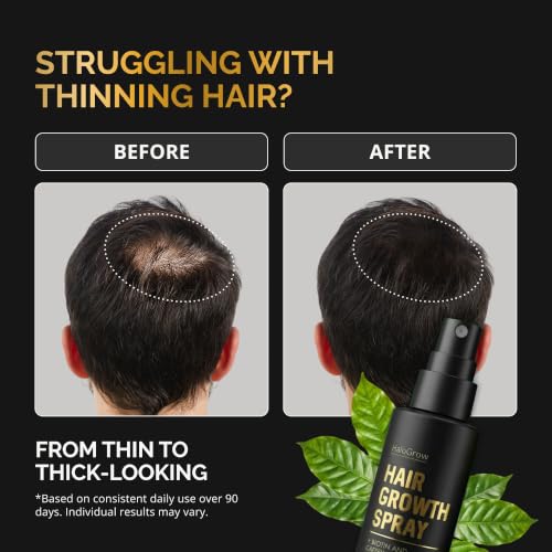 Hair Growth Serum Spray for Men & Women - Biotin & Caffeine, Anti-Thinning, 3 Pack, 1.7 Fl Oz