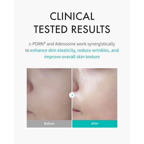 REJURAN¢ç Premium Sheet Mask Bundle ? Turnover Mask (5ea) + Skin Protection Mask (5ea) + Perfect V Tighter Dual-Sheet Mask (4ea) ? Salmon DNA c-PDRN¢ç for Hydration, Repair, Firming & Lifting