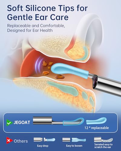 JEGOAT Midnight Blue 1296P HD Ear Wax Removal Camera with Smartphone App