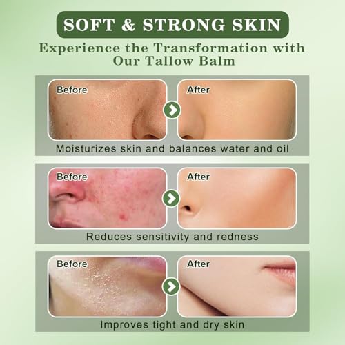 Beef Tallow and Honey Balm for Skin - All-Natural Moisturizer Hydrates and Nourishes the Skin, Grass-Fed Beef Tallow & Honey Balm Blend, Deeply Moisturizing for Face & Body Natural Skin Care