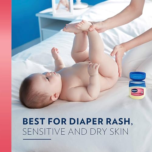 Vaseline Baby Petroleum Jelly 13oz Pack of 4 | Diaper Rash & Dry Skin Care