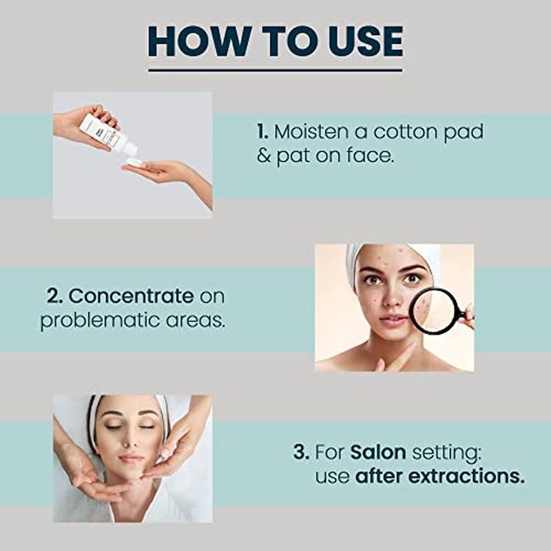 Azelaic Acid Acne Treatment Toner -10% Azelaic + 2% Salicylic Acid Serum for Face - Rosacea & Blackhead Care Best Acne Treatment for Women - Oil Control for Clear Skin - 4oz