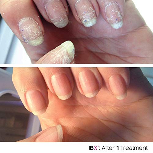 Nail Care Duo Set with Protecting and Restoring Nails & Free Cuticle Oil