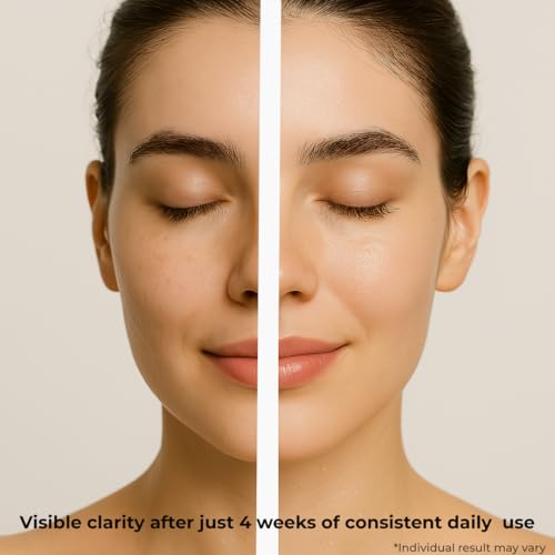 Exfoliating Cleansing Gel with Mineral Granules for Sensitive Skin ? Purifies Pores, Smooths & Refines Skin with Ginkgo Biloba & Red Algae. Dermatologically Tested, Gentle Daily Use