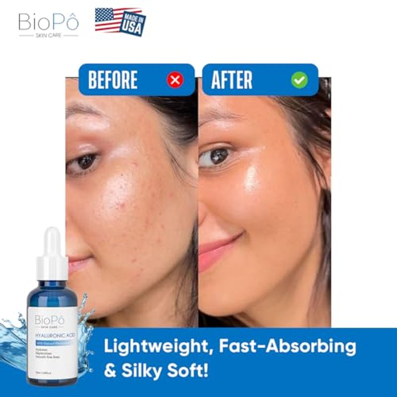 Hyaluronic Acid Serum 30 ml - Hydrating and Anti-Aging, Smooths Fine Lines, Replenishes Skin, Pure Hyaluronic Acid for Face & Skin - Suitable All Skin Types - Made in USA