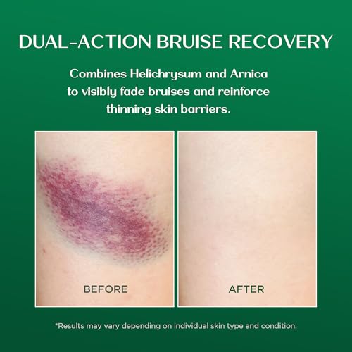 Vigority Arnica Bruise Cream 3.4oz with Helichrysum - Unscented, for Sensitive Skin, 1 Pack