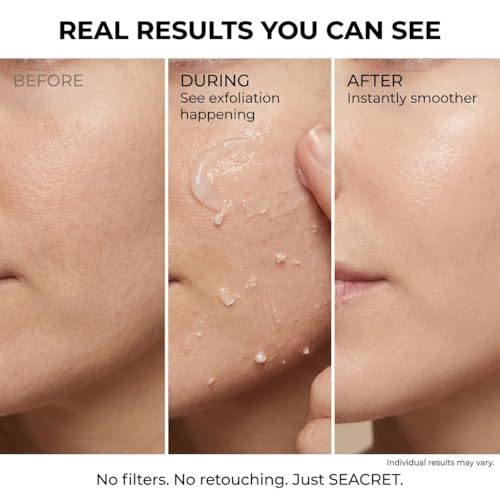SEACRET Mineral Rich Peeling Gel - Triple-Action Exfoliator with Glycolic Acid, Papaya Enzyme & Dead Sea Minerals for Smoother, Brighter Skin, Vegan & Cruelty-Free