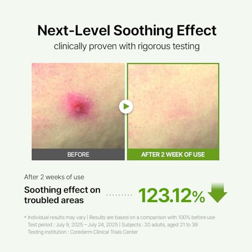 Calming Mugwort Toner for Sensitive Skin - Hydrating & Exfoliating, 200ml