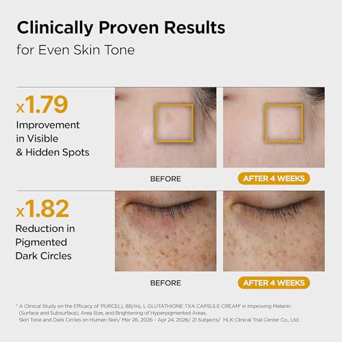 Tranexamic Acid Niacinamide Skin Brightening Cream - All Skin Types, 2.7 Fl Oz