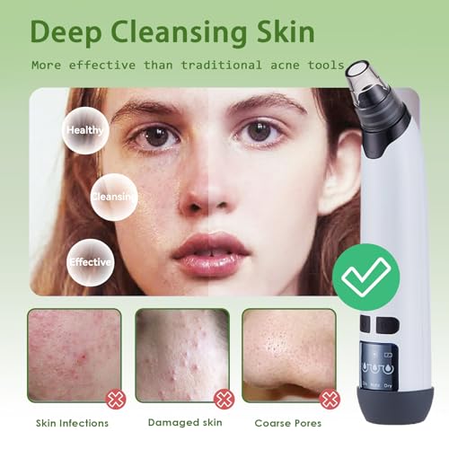 Blackhead Remover Pore Vacuum - Electric Facial Pore Cleaner with 3 Suction Levels & 3 Replaceable Probes - Professional Blackhead Extraction Tool Kit with 4 Stainless Steel Tools for Men & Women