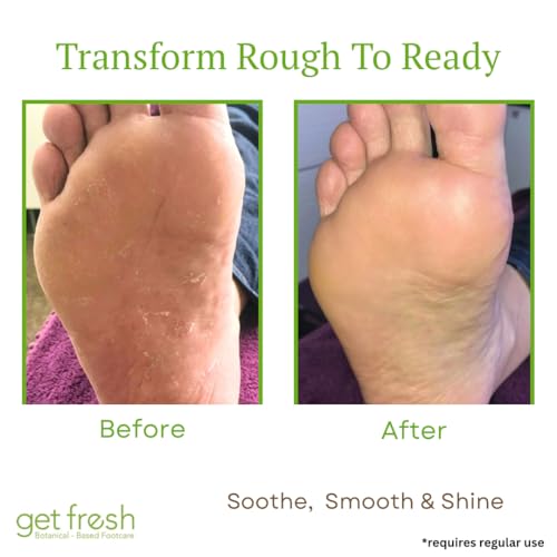 Intensive Foot Cream for Dry Skin & Cracked Heels - Shea & Aloe, 170g
