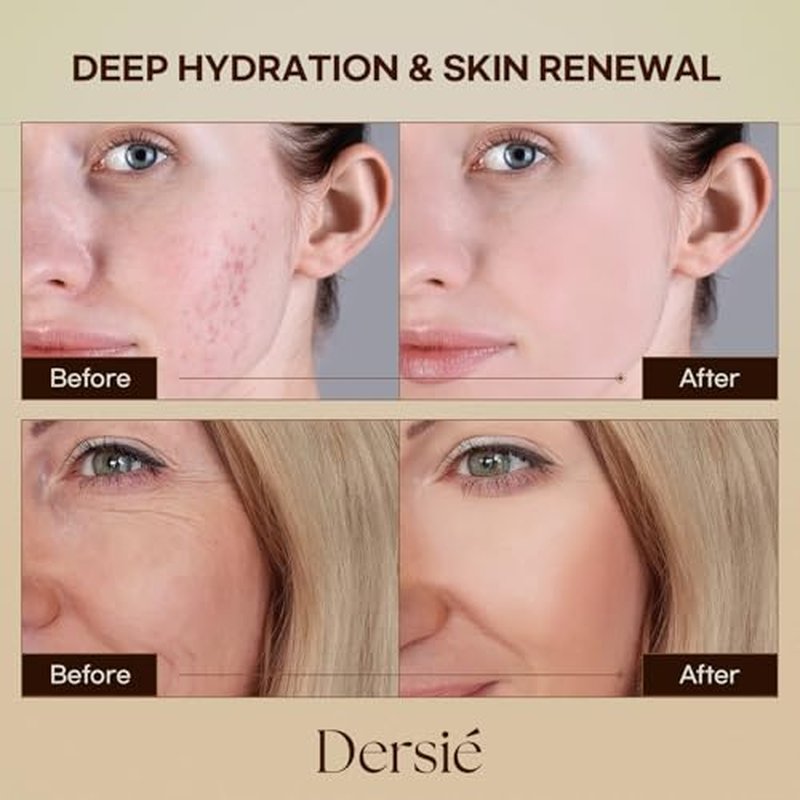 Dersie Tallow and Honey Balm for Face: 100% Grass-Fed Whipped Tallow Balm with Manuka Honey for Dry, Sensitive & Mature Skin ? Deep Hydration & Soothing ? Suitable for Women, Men & Kids (2.1 oz)