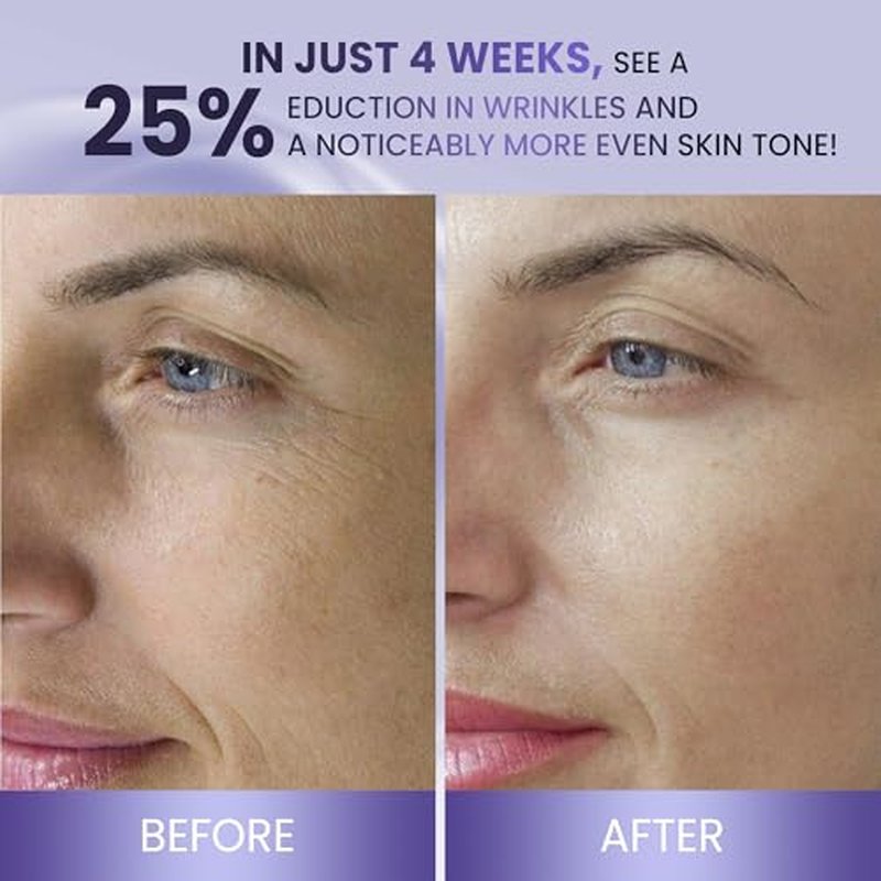 ABERA Belani Retinol Night Cream with Collagen & Hyaluronic Acid ? Anti-Wrinkle, Fine Line Smoother, Even Skin Tone, Hydrating Facial Moisturizer for Women (1.01 Fl Oz)