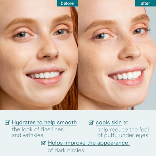 Cooling Under-Eye Gel for Dark Circles & Puffiness - 1.7 fl oz | Baebody