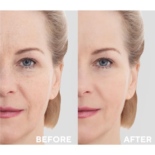 The Ceel Retinol Serum for Face | Resurfacing Retinol Serum | Firming, Anti aging, Brightening | Smoothing Fine Lines and Wrinkles | Retinol 1%, Ceramides and Niacinamide|1 fl.oz(30 ML)