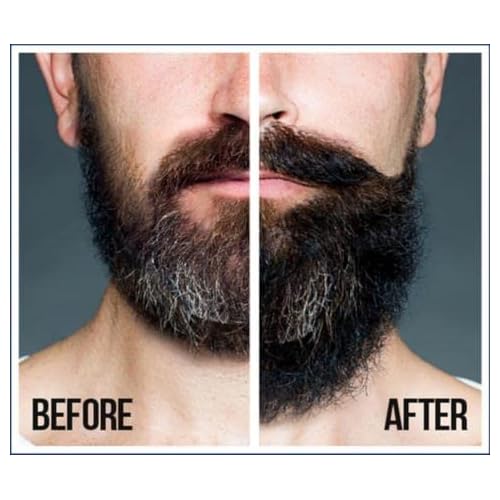 SFC Natural King Pro-growth Castor Hair & Beard Oil 7.1 oz