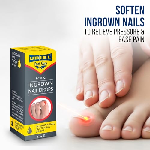 VYCE PrimalStep Toe Separators, Spreaders, Spacers, Straightener to Correct Toes for Men and Women, Bunion Corrector, Plantar Fasciitis and Athletic Mobility, Large (Pack of 2)