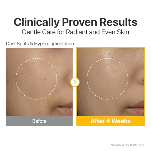 Dark Spots Serum Set with Glutathione & Vitamin C for Brightening