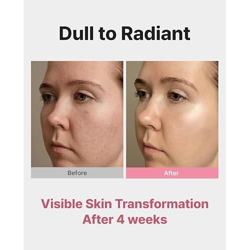 Delere Caviar AHA 3% Glow Toner | Korean Collagen Exfoliating Toner | Korean Exfoliator for Radiance, Collagen Skin Care, 250ml