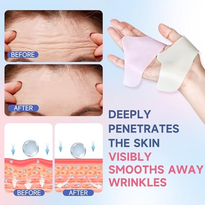 60 Count Nose Pore Patches, Medical-Grade Hydrocolloid Pore Strips, Overnight Oil-Absorbing & Pore-Refining, Pimple Stickers to Absorb Acne Nose Gunk