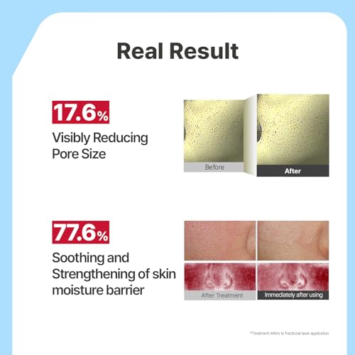 Illiyoon Ceramide Collagen Hydrogel Sleep Mask for Hydrating & Pore Tightening