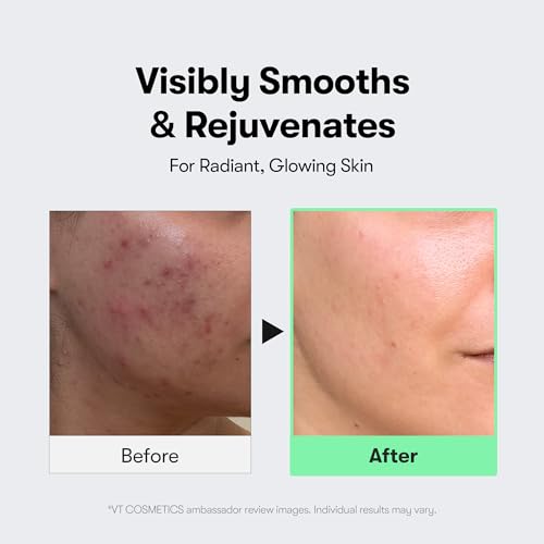 VT COSMETICS Reedle Shot Set - CICA Skincare for All Levels