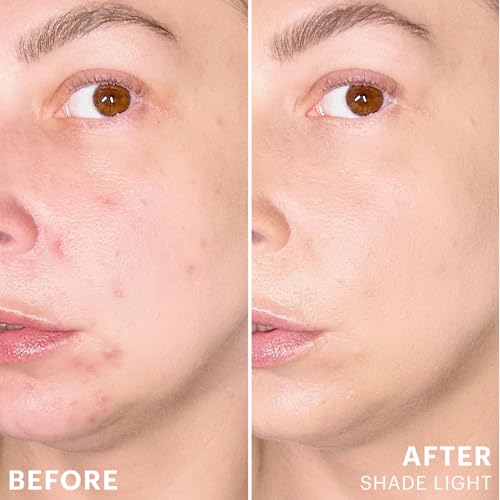Glo Skin Beauty Spot Treat Concealer Light Salicylic Acid Acne Coverage