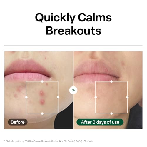 Dr.G R.E.D. Blemish Clear Hyal-Cica Facial Serum 1.69 fl oz - Hydrating & Soothing Skincare