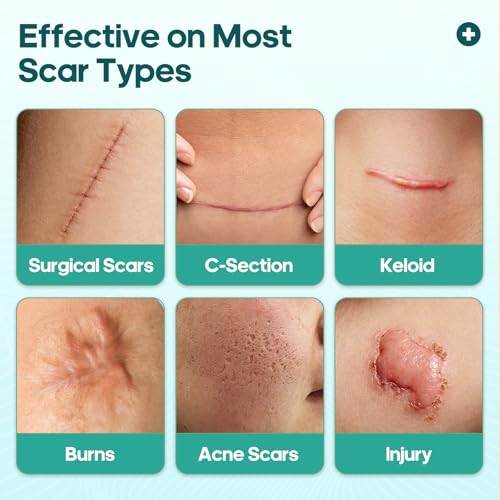 Silicone Gel Patch, Scar Removal Tape for C-Section£¬Surgical£¬Tummy Tuck£¬Burn, Acne, Keloid Bump Removal(1.6"X 120" Roll-3M) Surgery Recovery Items£¬Reusable Scar Away Silicone Sheets