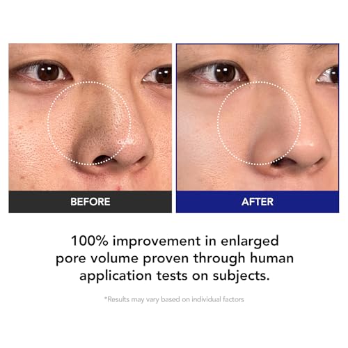 Smaller Pores Toner Pads for Oil Control & Black Spots - 70 Count