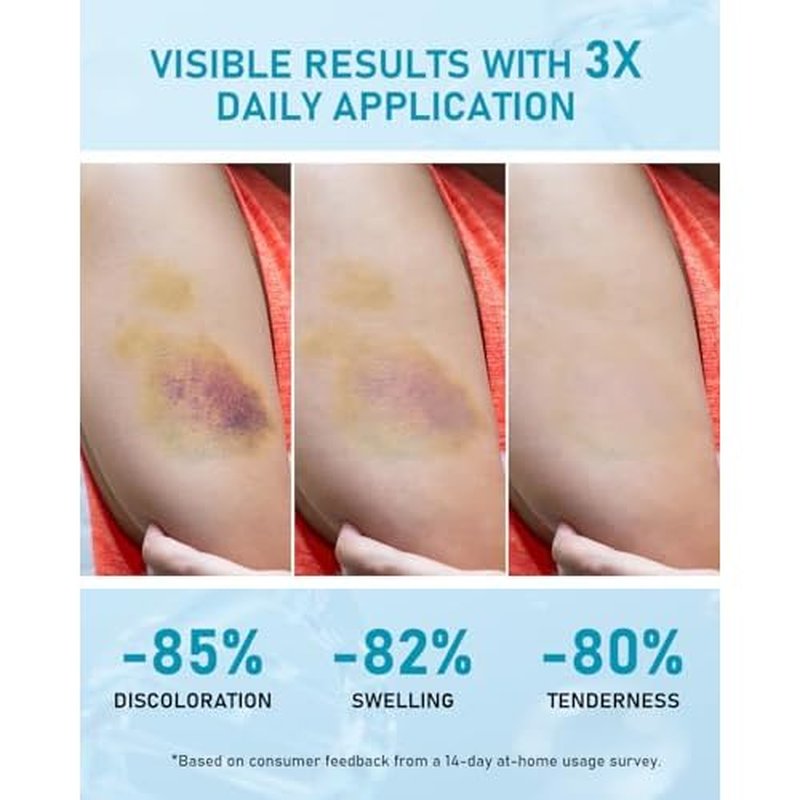 Arnica Bruise Relief Cream Extra Strength: Soothing Moisturizer with Vitamin K, C & E for Thin & Sensitive Skin - Daily Care for Teens, Adults & Mature Skin (3 Oz * 2 PCS)
