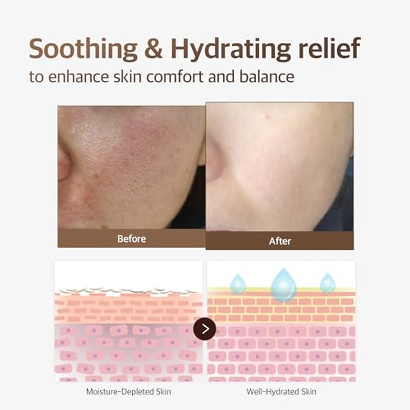 GD11 Rx SCM Program | Soothing & Hydrating Recovery Face Serum with Stem Cell Exosomes, CICA & Panthenol | Refreshing Daily Exosome Treatment | Gentle K-Beauty Ampoule for Sensitive Skin, 1 Pair