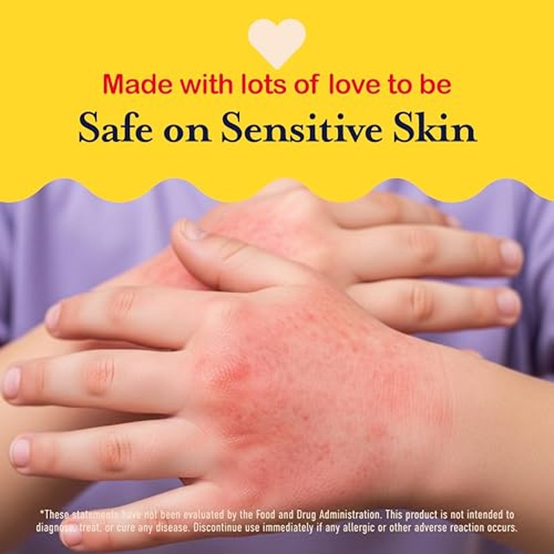 Hypochlorous Acid Spray For Kids - Soothes Diaper Rash, Baby Acne, Eczema, Cuts & Scrapes - Baby & Kids Skin Soothing Spray for Sensitive Skin, Non-Toxic, No Sting, 4 oz
