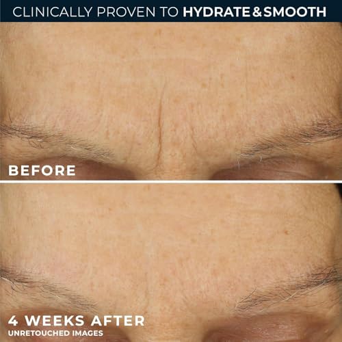 RoC Retinol Correxion Max Daily Hydration Face Moisturizer,