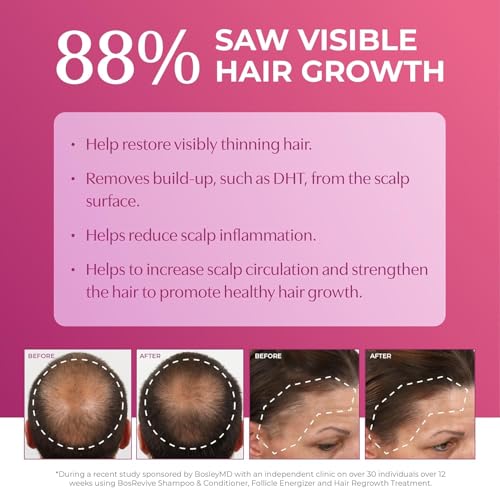 Women Hair Regrowth Treatment Foam - Minoxidil 5% Extra Strength, No-Drip, Fast Absorbing, 2-Month Supply