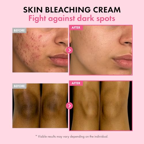 Dark Spot Fade Cream for Hyperpigmentation & Uneven Skin - 50ml