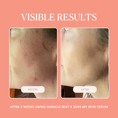 LUMIONskin Miracle Mist Purifying Hypochlorous Acid Spray 3.4 oz - Calming & Hydrating Face Mist (Variation of THIS listing)