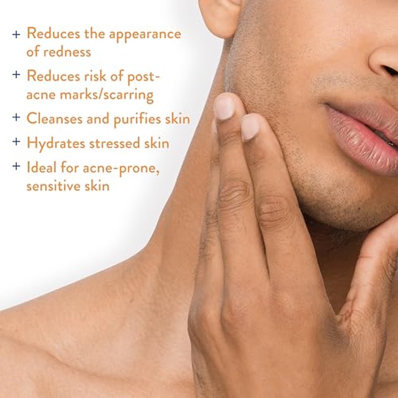 AcneFree Hypochlorous Acid Soothing Spray for Face & Body ? Redness Relief Mist for Acne-Prone, Sensitive, or Irritated Skin ? Gentle Daily Spray for Breakout Support & Skin Barrier Balance ? 4 ounce