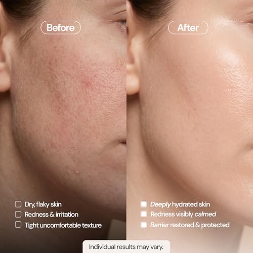 Manuka Cream for Sensitive Skin 2 oz - Fragrance-Free, Steroid-Free Moisturizer