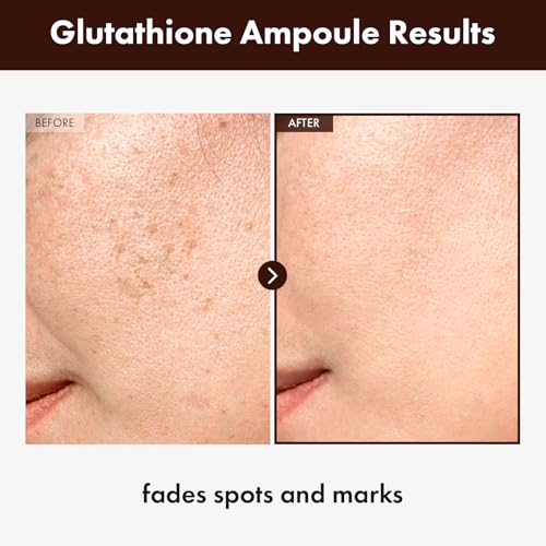 TOSOWOONG Glutathione 2% Serum - 1.01 Fl Oz Anti-Aging & Brightening