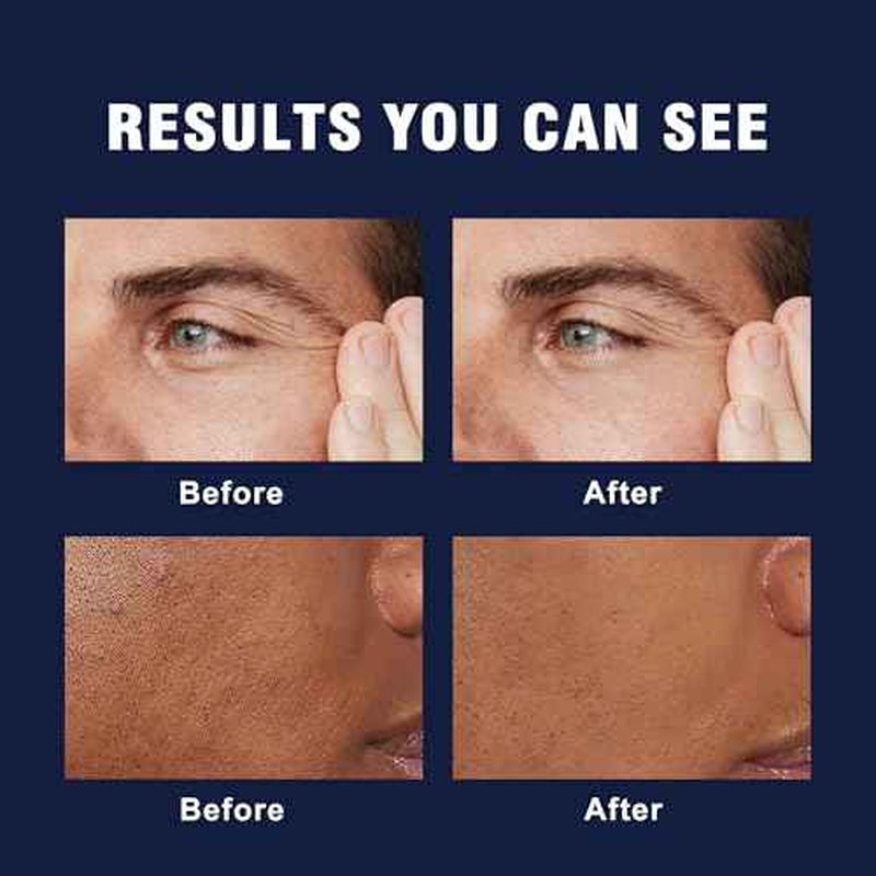 6-in-1 Face Cream for Men ? Mens Anti Aging Face Cream w/Caffeine & Retinol to Firm, Hydrate & Refresh Skin, Quick-Absorbing Non-Greasy Formula