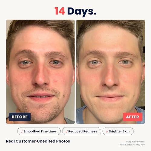 Men's Face Moisturizer for Dark Circles Brightening Anti-Aging Hydrating Cream