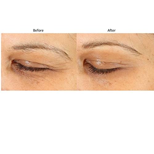 Bluelene EyePlus+, a new formula powered by the ultimate trifecta of Methylene Blue, Ergothioneine, and Niacinamide. Dermatologist approved. Suitable for Sensitive Skin.